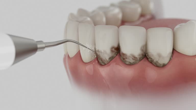 Reliable Dental Implants contractor in Valley Park, MO by Smile Center Dentistry